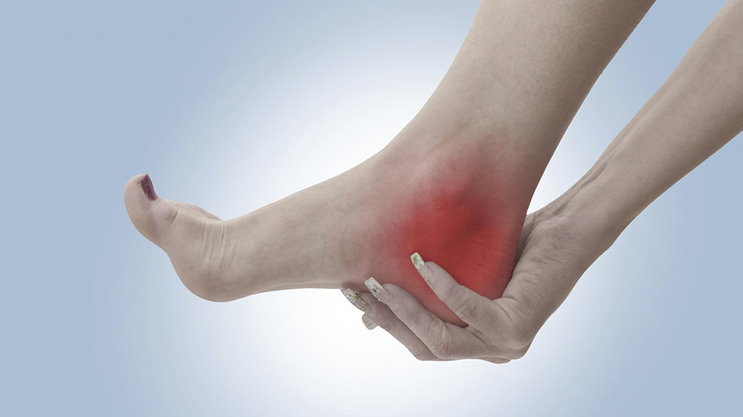 Suffering from Plantar Fasciitis?