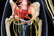 Sciatica Treatment