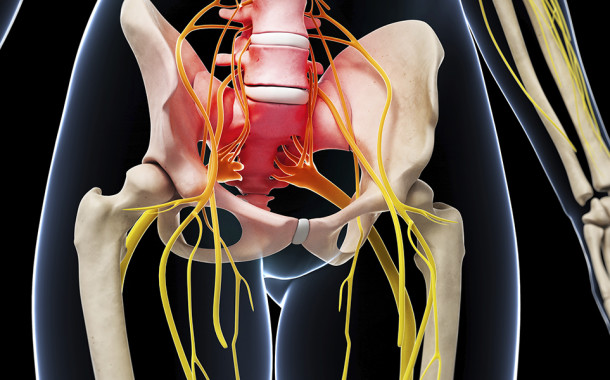 Sciatica Treatment
