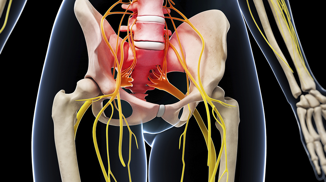 Chiropractic Care and Herniated Discs