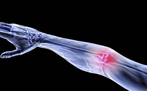 The 101 on Pinched Nerves